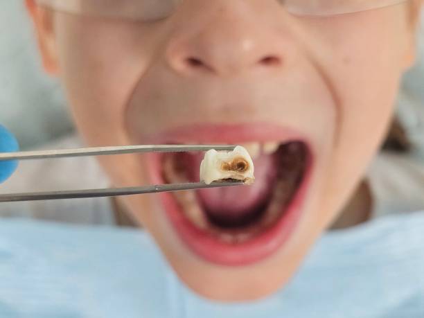 Best Emergency Dentist for Knocked-Out Tooth in Schwenksville, PA